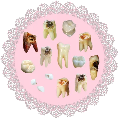 Thanks I Hate It Rtihi Transparent Lace Circle Png Teeth Icon Tumblr