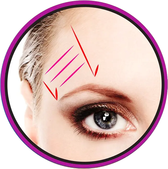 Pdo Threading Barcode Lift Eyebrow Glabella Hot Springs Surgery And Vein Clinic Png Eyebrow Png