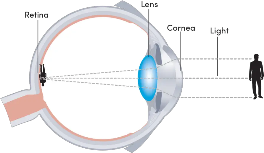 Dr Joanne Goh Laser Eye Surgeon Circle Png Laser Eye Png