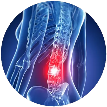 Back Pain Sportswise Columna Vertebral Imagenes 3d Png Pain Png