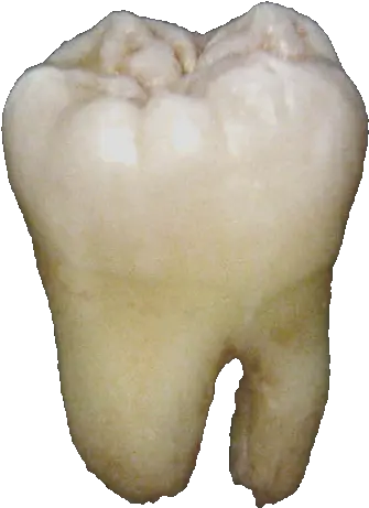 Lower Wisdom Tooth Tooth Png Tooth Png