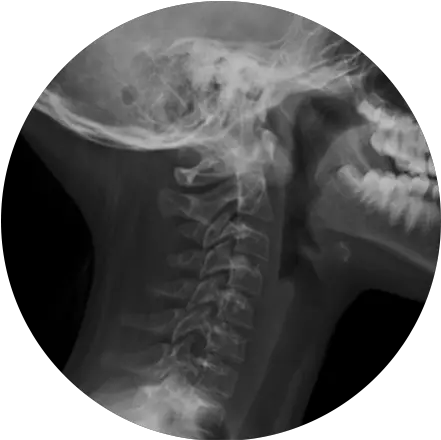 Digital X Radiology Transparent Png X Ray Png