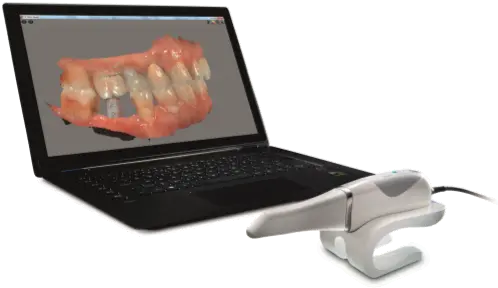 Cs 3600 For Implant Planning Scanner Carestream 3600 Preço Png Icon Logicon 6