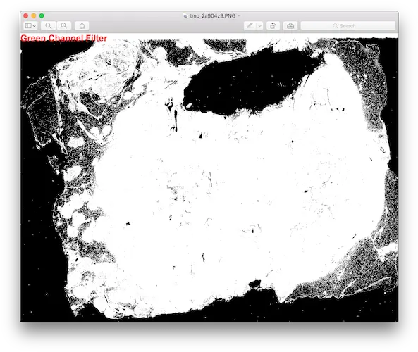 Apply Filters For Tissue Segmentation U2013 Ibm Developer Screenshot Png Photo Filter Png
